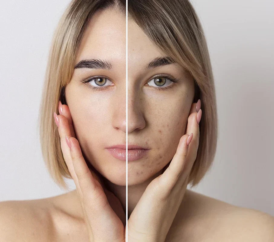 Masajeador facial Trendencias InstaGlow™ "Envio Gratis a todo Guatemala "